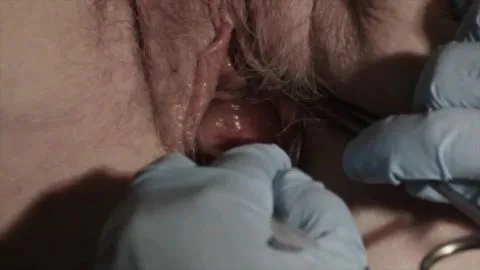 Gynecological Medical Films 40