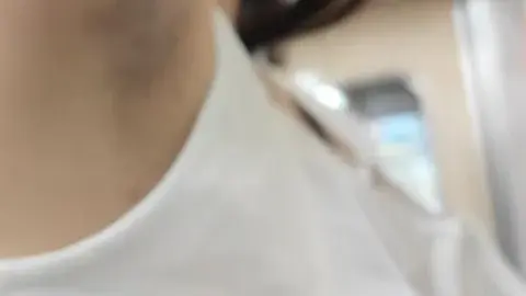 Asian Woman Shows Underarm Hair