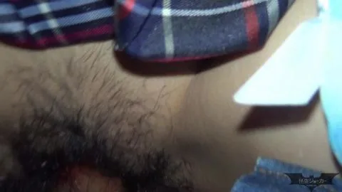 Hairy Man Treating Genital Injury